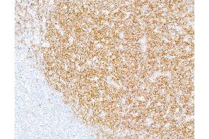 Immunohistochemistry (IHC) image for anti-CD19 Molecule (CD19) (AA 21-291) antibody (ABIN7449425) (Recombinant CD19 anticorps  (AA 21-291))