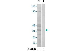 Western blot analysis of extracts from Jurkat cells, using BNIP2 polyclonal antibody . (BNIP2 anticorps  (C-Term))