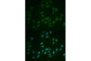 Immunofluorescence analysis of MCF-7 cells using LIG1 antibody. (LIG1 anticorps  (AA 565-790))