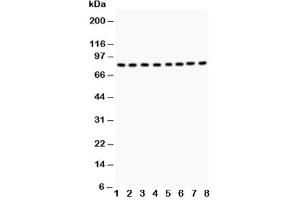 Western blot testing of BRAF antibody and Lane 1:  rat testis tissue (BRAF anticorps  (AA 38-230))