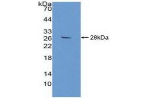 Detection of Recombinant aZGP1, Human using Polyclonal Antibody to Alpha-2-Glycoprotein 1, Zinc Binding (aZGP1)