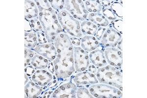 Immunohistochemistry of paraffin-embedded rat kidney using MonoMethyl-Histone H3-K27 Rabbit pAb (ABIN3023262, ABIN3023263, ABIN3023264, ABIN1513004 and ABIN6219518) at dilution of 1:100 (40x lens). (Histone 3 anticorps  (H3K27me1))