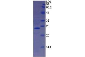 SDS-PAGE analysis of Sheep Hemoglobin beta Protein. (Hemoglobin Subunit beta Protéine)