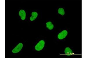 Immunofluorescence of monoclonal antibody to NFATC2IP on HeLa cell.