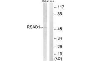 Western blot analysis of extracts from HeLa cells, using RSAD1 Antibody. (RSAD1 anticorps  (AA 298-347))