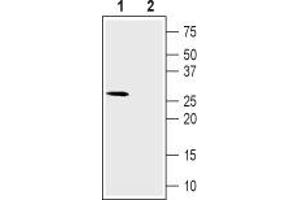 Western blot analysis of rat skeletal muscle lysate: - 1. (CACNG6 anticorps  (1st Extracellular Loop))