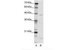Image no. 1 for anti-Thyroid Hormone Receptor Interactor 13 (TRIP13) (C-Term) antibody (ABIN202512) (TRIP13 anticorps  (C-Term))