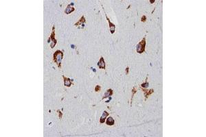 Immunohistochemical staining of paraffin-embedded human brain section reacted with RPS6 monoclonal antibody  at 1:25 dilution. (RPS6 anticorps)