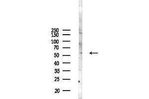 anti-tRNA Splicing Endonuclease 54 (TSEN54) (Internal Region) antibody