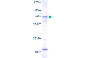Image no. 1 for Solute Carrier Family 25 (Mitochondrial Carrier, Phosphate Carrier), Member 3 (SLC25A3) (AA 1-361) protein (GST tag) (ABIN1320283)
