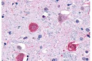Immunohistochemistry (Formalin/PFA-fixed paraffin-embedded sections) of human brain, neurons and glia with GPR1 polyclonal antibody . (G Protein-Coupled Receptor 1 anticorps  (C-Term))