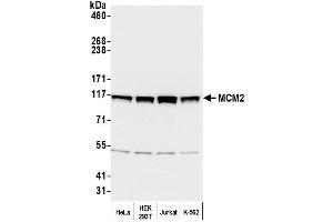 Western Blotting (WB) image for anti-Minichromosome Maintenance Complex Component 2 (MCM2) (AA 1-50) antibody (ABIN7453952)