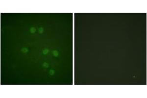 Immunofluorescence analysis of HepG2 cells, using HMG14 (Ab-21) Antibody. (HMGN1 anticorps  (AA 10-59))