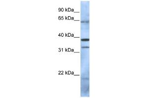 WB Suggested Anti-PCGF5 Antibody Titration:  0. (PCGF5 anticorps  (N-Term))