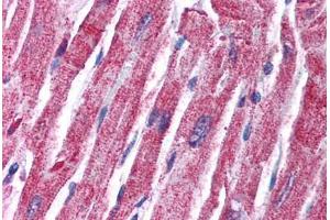 Human Heart (formalin-fixed, paraffin-embedded) stained with MAPK14 antibody ABIN214794 at 2.