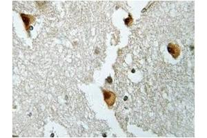Image no. 1 for anti-Aldolase B, Fructose-Bisphosphate (ALDOB) antibody (ABIN317837)