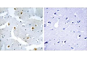 Peptide - +Immunohistochemistry analysis of paraffin-embedded human brain tissue using FMN2 antibody. (Formin 2 anticorps  (Internal Region))