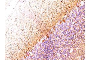 Formalin-fixed, paraffin-embedded human Cerebellum stained with Neurofilament Monoclonal Antibody (RT-97 + NR-4). (NEFH & NEFL anticorps)