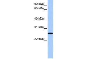 WB Suggested Anti-FBXO36 Antibody Titration: 0. (FBXO36 anticorps  (N-Term))