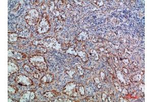 Immunohistochemical analysis of paraffin-embedded human-spleen, antibody was diluted at 1:200 (LTB anticorps  (AA 41-90))