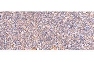 Immunohistochemistry of paraffin-embedded Human tonsil tissue using LMCD1 Polyclonal Antibody at dilution of 1:100(x200)