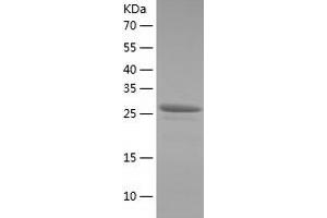 Western Blotting (WB) image for Zinc Finger Protein 562 (ZNF562) (AA 152-414) protein (His tag) (ABIN7125795) (ZNF562 Protein (AA 152-414) (His tag))