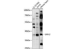 Western blot analysis of extracts of various cell lines, using SPRY2 antibody  at 1:1000 dilution. (SPRY2 anticorps  (AA 1-100))