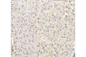Immunohistochemistry (IHC) image for anti-RAN, Member RAS Oncogene Family (RAN) (AA 166-216) antibody (ABIN7455018) (RAN anticorps  (AA 166-216))