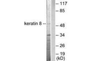 Western blot analysis of extracts from SKOV3 cells, using Keratin 8 Antibody. (KRT8 anticorps  (AA 434-483))