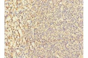 Immunohistochemistry of paraffin-embedded human tonsil tissue using ABIN7171457 at dilution of 1:100 (LY9 anticorps  (AA 160-360))