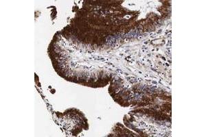 Immunohistochemical staining of human gallbladder with CKAP4 polyclonal antibody  shows distinct cytoplasmic positivity in glandular cells. (CKAP4 anticorps  (AA 411-520))