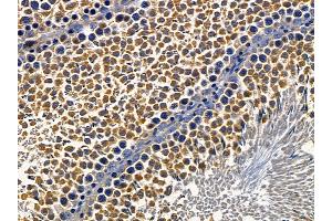 ABIN6257500 and ABIN6274303 at 1/100 staining rat testis tissue by IHC-P. (ST5 anticorps  (Internal Region))