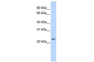 RAB8A antibody (70R-10557) used at 0. (RAB8A anticorps  (Middle Region))