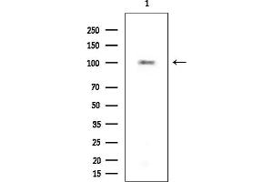 Western blot analysis of lysates from Mouse liver, using Hexokinase 1 Mouse Monoclonal Antibody at 1/1000 dilution.