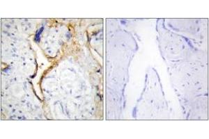Immunohistochemistry analysis of paraffin-embedded human placenta tissue, using CKI-epsilon Antibody. (CK1 epsilon anticorps  (AA 276-325))