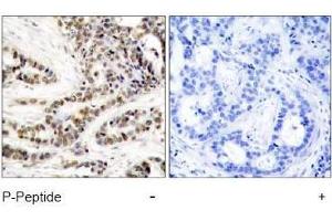 Image no. 1 for anti-cAMP Responsive Element Binding Protein 1 (CREB1) (pSer129) antibody (ABIN197039) (CREB1 anticorps  (pSer129))