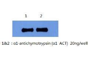 Western Blotting (WB) image for anti-serpin Peptidase Inhibitor, Clade A (Alpha-1 Antiproteinase, Antitrypsin), Member 3 (SERPINA3) antibody (ABIN1105305) (SERPINA3 anticorps)