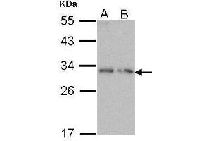 WB Image Sample (30 ug of whole cell lysate) A: Molt-4 , B: Raji 12% SDS PAGE antibody diluted at 1:1000 (PDYN anticorps)