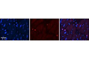 Rabbit Anti-Ppara Antibody  Catalog Number: ARP34068_P050 Formalin Fixed Paraffin Embedded Tissue: Human Adult heart  Observed Staining: Nuclear Primary Antibody Concentration: 1:600 Secondary Antibody: Donkey anti-Rabbit-Cy2/3 Secondary Antibody Concentration: 1:200 Magnification: 20X Exposure Time: 0.