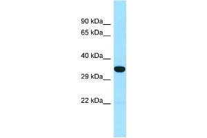 WB Suggested Anti-SNX15 Antibody Titration: 1. (SNX15 anticorps  (N-Term))