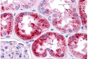 Human Kidney: Formalin-Fixed, Paraffin-Embedded (FFPE)