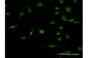 Immunofluorescence of monoclonal antibody to AAK1 on HeLa cell.