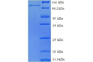 SDS-PAGE (SDS) image for RAR-Related Orphan Receptor C (RORC) (AA 1-518), (full length) protein (His-SUMO Tag) (ABIN5710270)