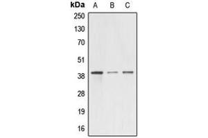 Western blot analysis of A4GNT expression in HEK293T (A), mouse testis (B), rat kidney (C) whole cell lysates.