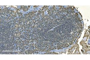IHC analysis of CD20/MS4A1 using anti-CD20/MS4A1 antibody (ABIN7599233). (CD20 anticorps  (AA 1-297))