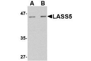 Image no. 1 for anti-LAG1 Homolog, Ceramide Synthase 5 (LASS5) (N-Term) antibody (ABIN342684) (LASS5 anticorps  (N-Term))