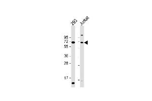 All lanes : Anti-CYP2B6 Antibody (Center) at 1:2000 dilution Lane 1: 293 whole cell lysate Lane 2: Jurkat whole cell lysate Lysates/proteins at 20 μg per lane. (CYP2B6 anticorps  (AA 235-263))