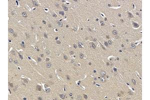 ABIN6257961 and ABIN6274900 at 1/100 staining rat liver tissue by IHC-P. (BOK anticorps  (N-Term))