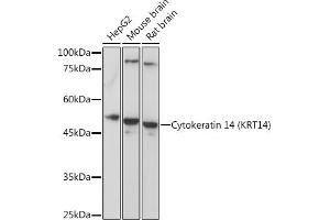 Western blot analysis of extracts of various cell lines, using Cytokeratin 14 (Cytokeratin 14 (KRT14)) Rabbit pAb (ABIN7268092) at 1:5000 dilution. (KRT14 anticorps  (C-Term))