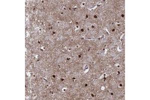 Immunohistochemical staining of human cerebral cortex with RAVER2 polyclonal antibody  shows strong nuclear positivity in neuronal cells and glial cells at 1:50-1:200 dilution. (RAVER2 anticorps)
